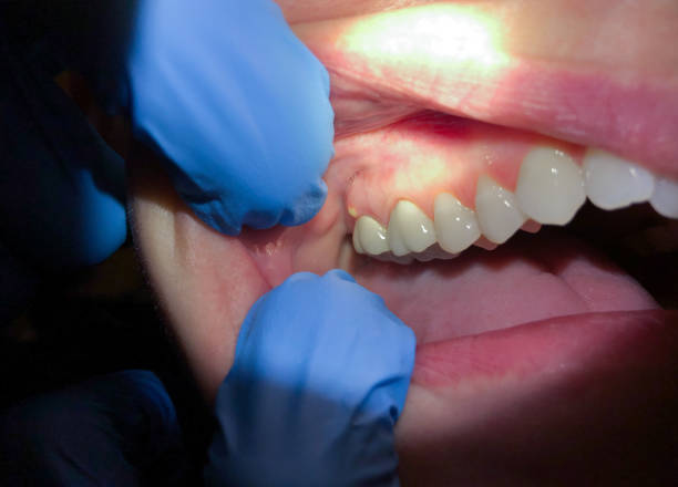 Best Weekend Emergency Dentist in Franklin Grove, IL